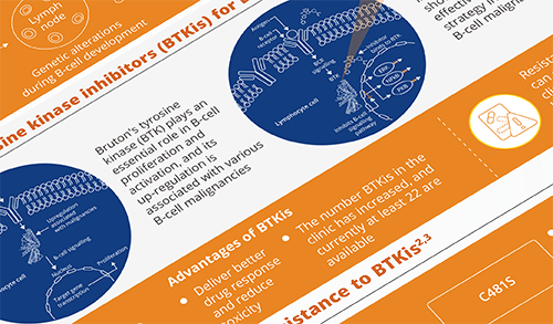 Infographic - Optimising the Treatment of B-Cell Malignancies